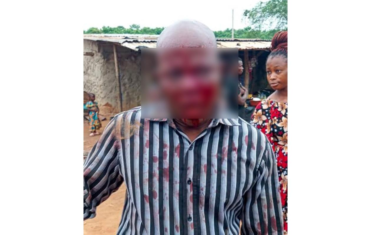 Tiassalé : un directeur d’école violemment agressé à la machette chez lui