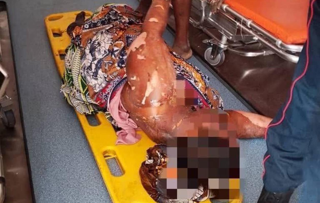 Abobo : Une fuite de gaz fait 11 blessés graves, le GSPM mobilisé