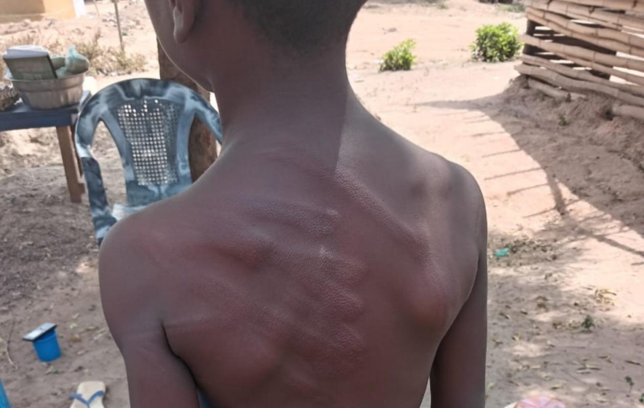 Mahapleu sous le choc : la punition d’un élève de 7 ans ravive les inquiétudes autour de l’école