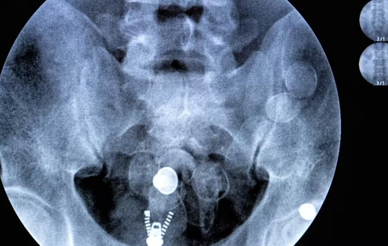 Trafic de drogue : 6,6 tonnes de stupéfiants saisies sur des mules aériennes en 2025