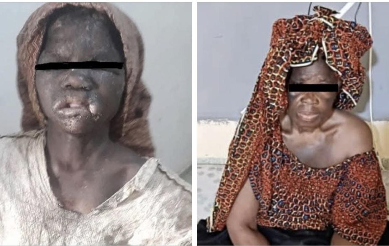 Bouaké : une grand-mère de 72 ans interpellée pour sévices sur sa petite-fille