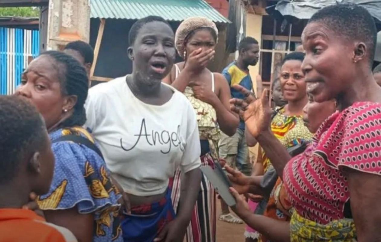 Horreur à Afféry : une élève gravement brûlée dans une présumée attaque à l’acide