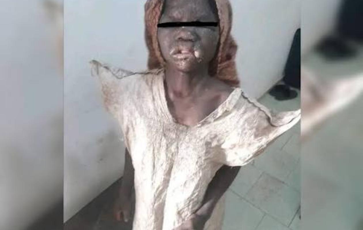 Bouaké : une fillette libérée d’un poulailler et prise en charge par le MFFE