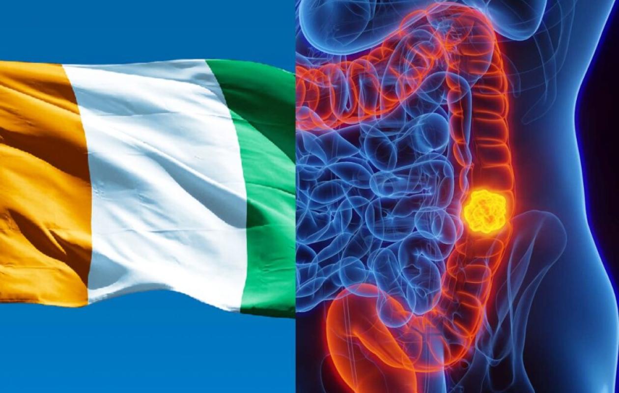 Lutte contre le cancer colorectal : Top départ pour la grande campagne de dépistage au CNRAO !