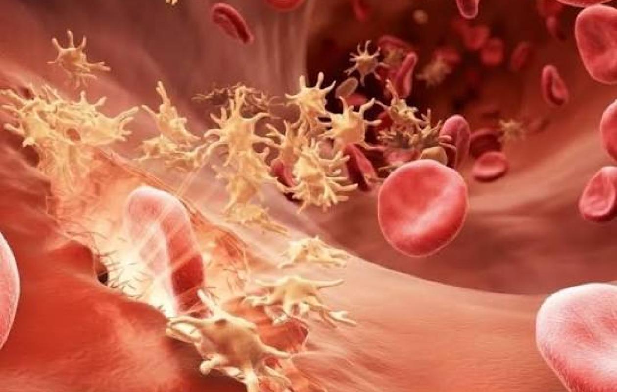 Journée mondiale de l’hémophilie 2026 : l’urgence d’un diagnostic précoce mise en avant