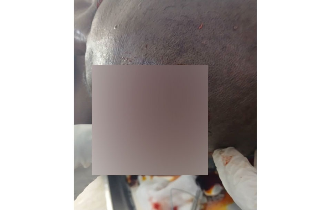 Kouto–Samorossoba : un conflit foncier fait près d’une vingtaine de blessés