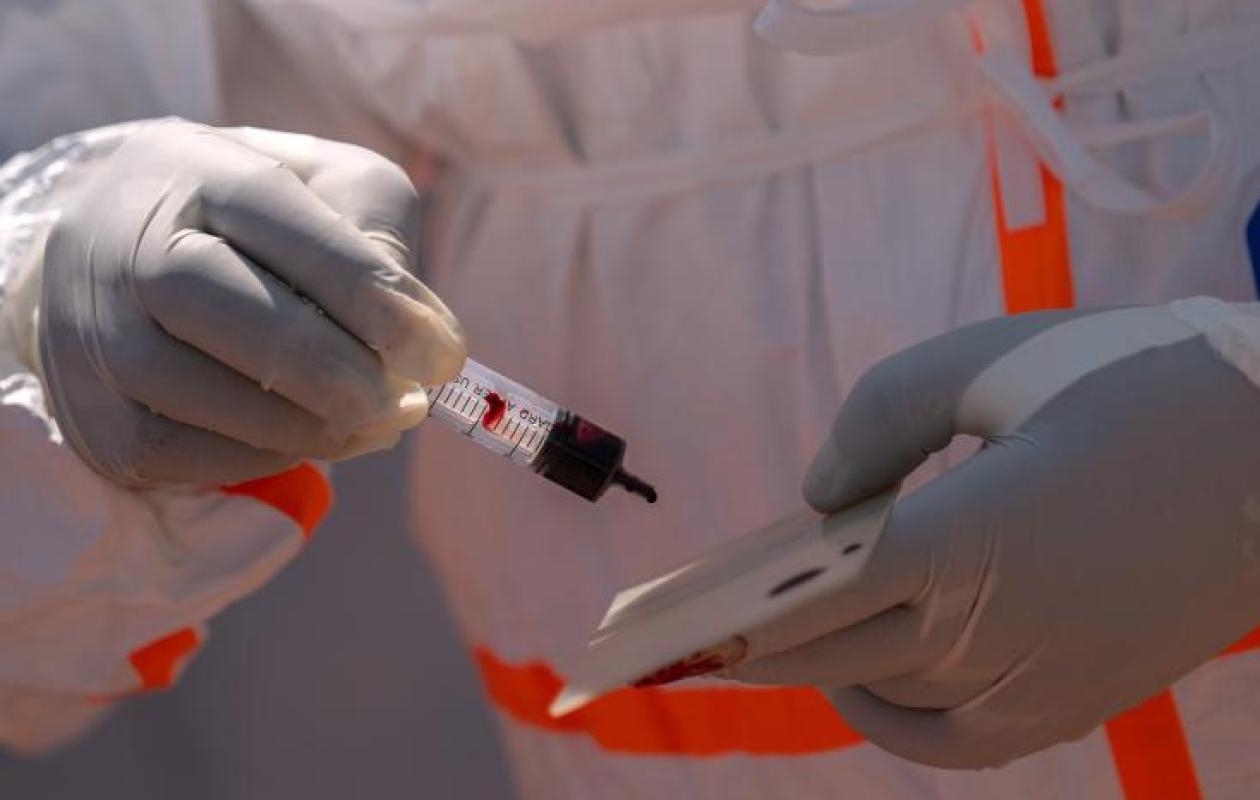 Ebola: un premier cas du virus détecté en France chez un médecin de retour de la RD Congo